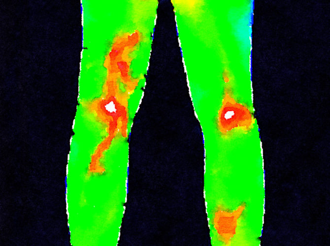 THERMOGRAPHY – Family Naturopathic Clinic